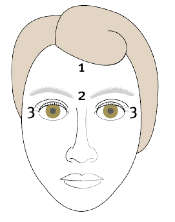 Behandelzones Botoxbehandeling Focuskliniek