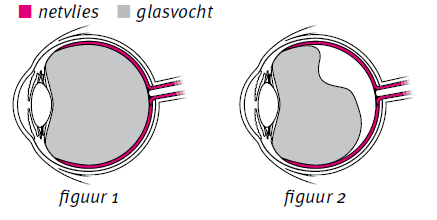 Glasvochtloslating