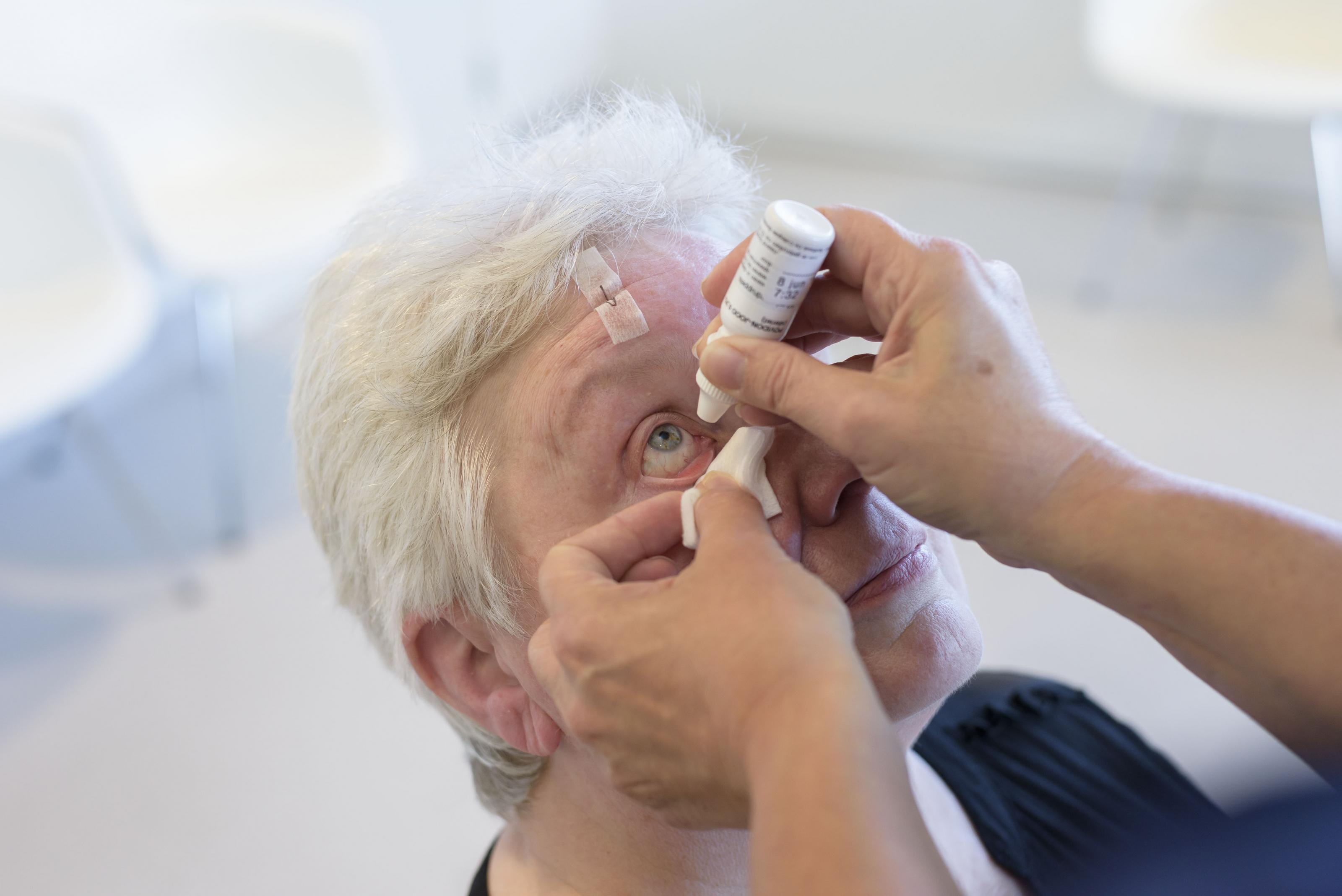 Uw oog wordt gedruppeld om uw pupil wijder te maken, dit maakt het voor de chirurg mogelijk om uw oog te opereren.