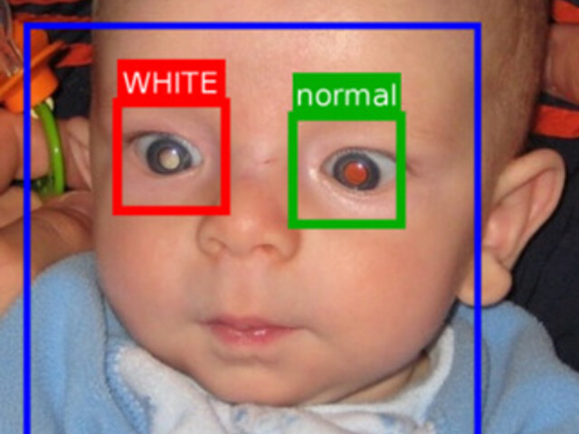 White eye app (Cradle)