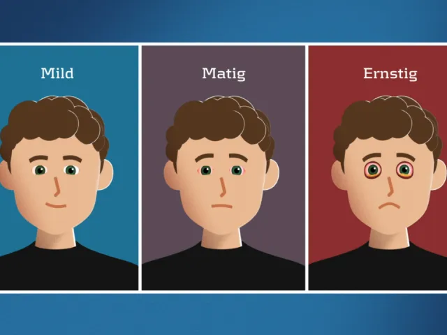 Animatievideo Graves' orbitopathie?